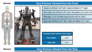 Optimus Spine & Posture Assessment
