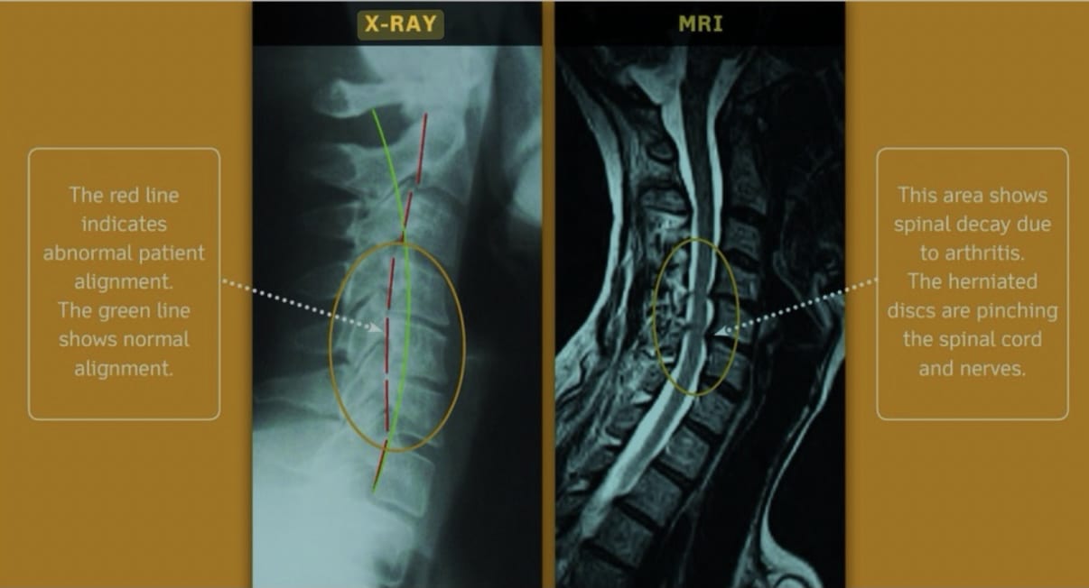 X-Ray Analysis Comparison