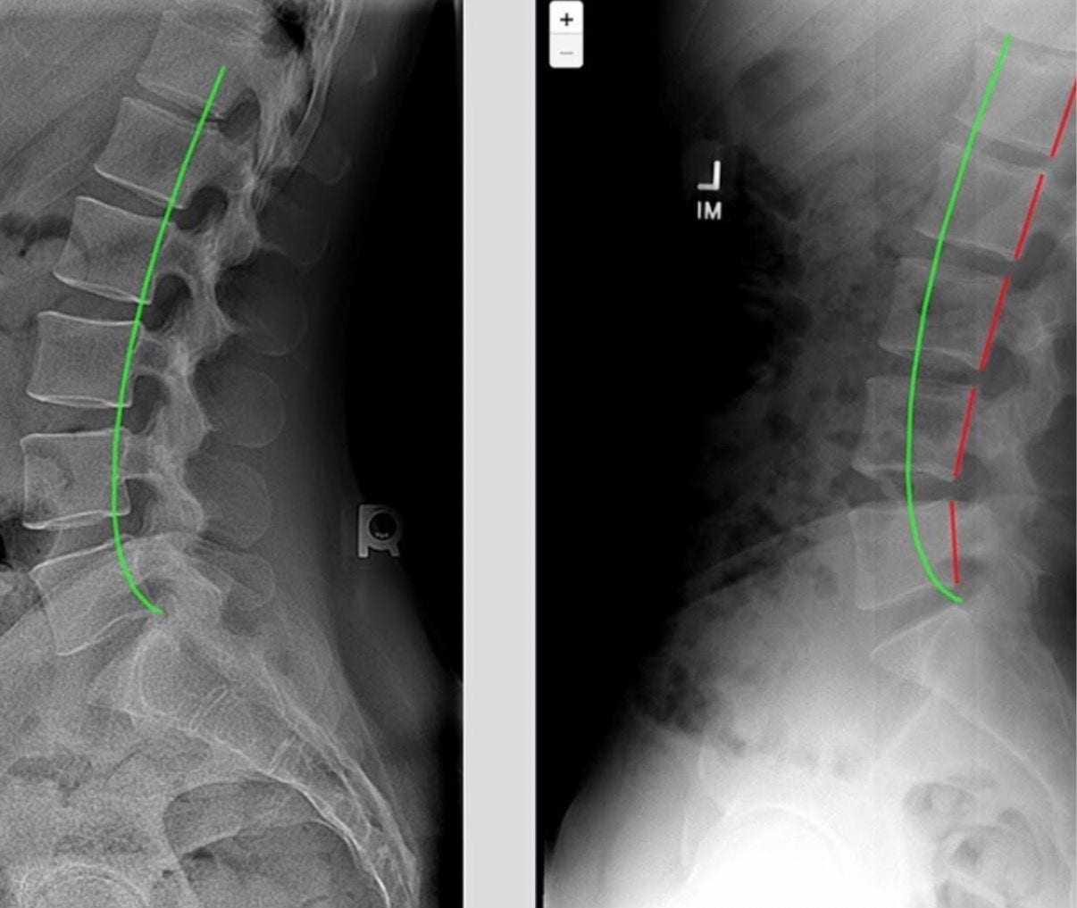 Structural Correction X-Ray