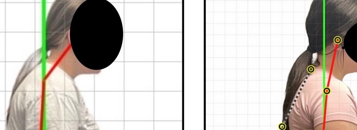 Posture Grid Analysis
